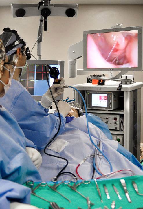 Müasir üsul olan endoskop ilə adenoidektomiya (Burun əti kəsilməsi) 1